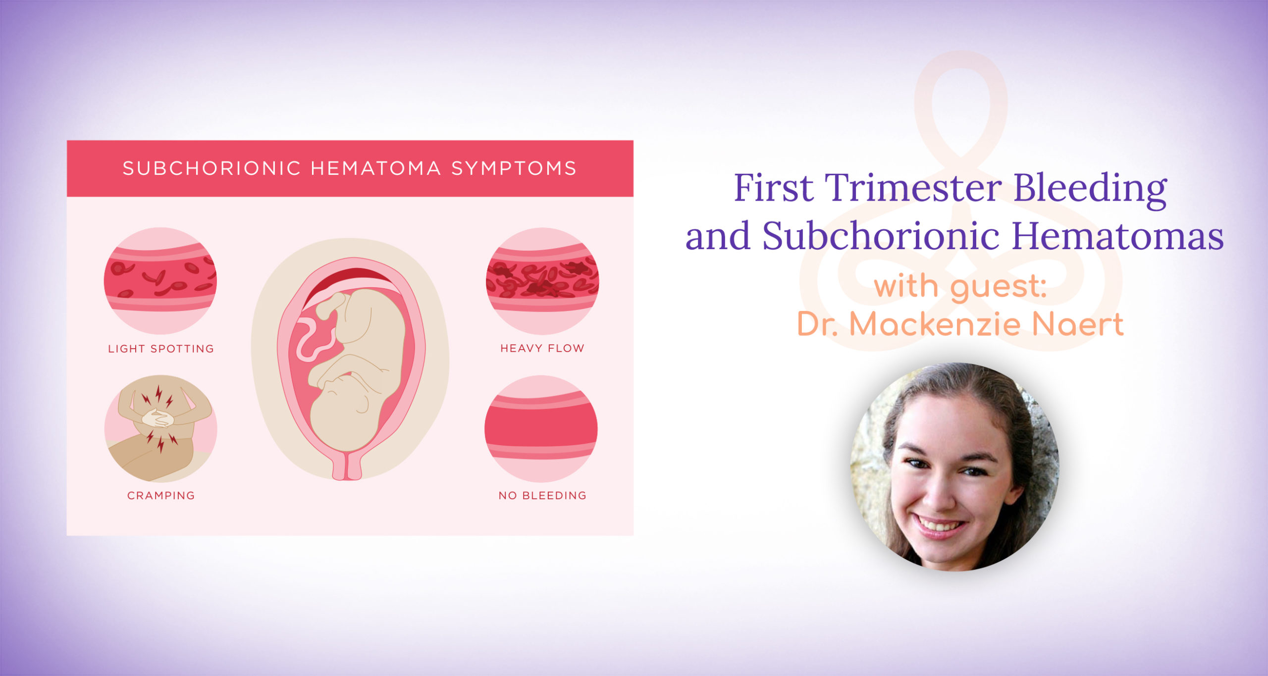 "First Trimester Bleeding and Subchorionic Hematomas" with Dr